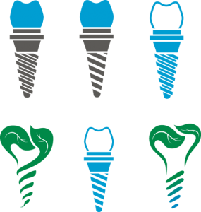 Dental-Implants