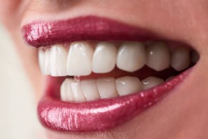 full smile