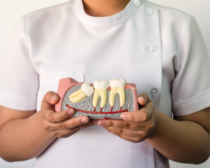 impacted wisdom tooth diagram