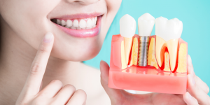 Girl smiling with bone graft and dental implant
