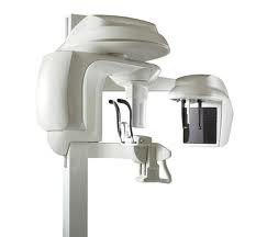 3D Scanner