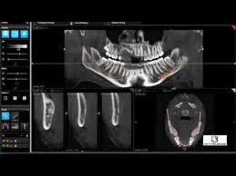 3d images of mouth